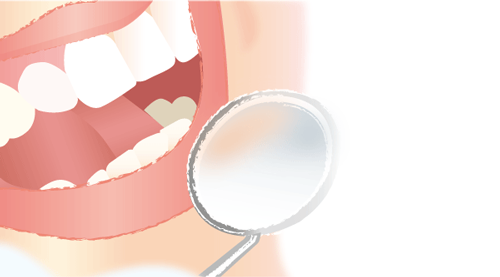 定期健診で虫歯、歯周病予防